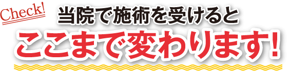当院で施術で受けるとここまで変わります!
